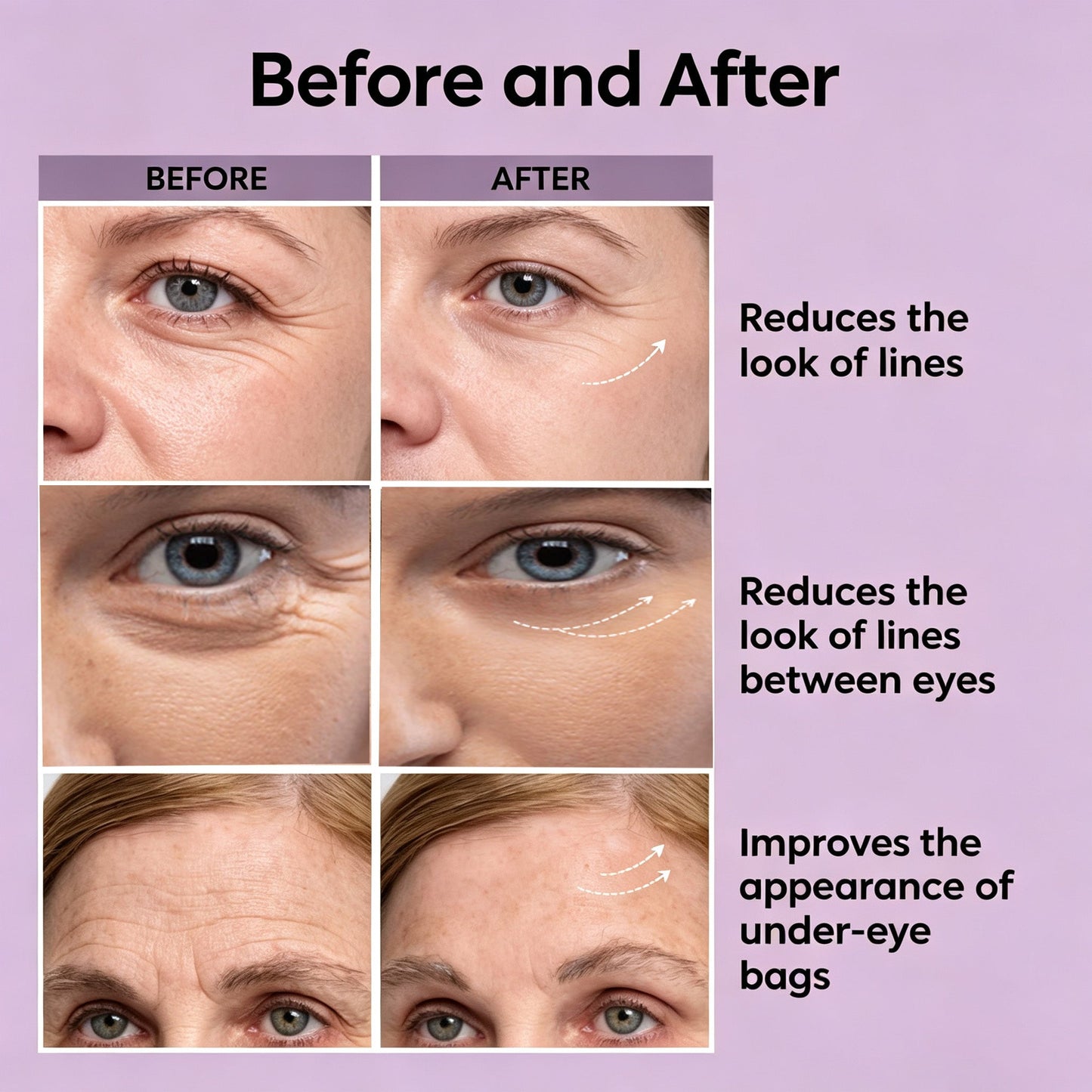 Medicuubeus™ Instant Firmx Face Cream Eye Tightener