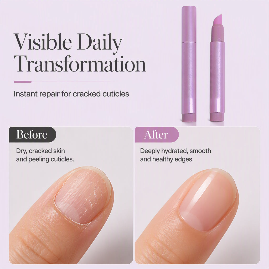 🎁Portable Nail Care Essence Pen – Precise Cuticle Moisturizing Treatment, Smooth Applicator Tip & Compact Travel-Friendly Design – Healthy Nails Anywhere, Anytime💅